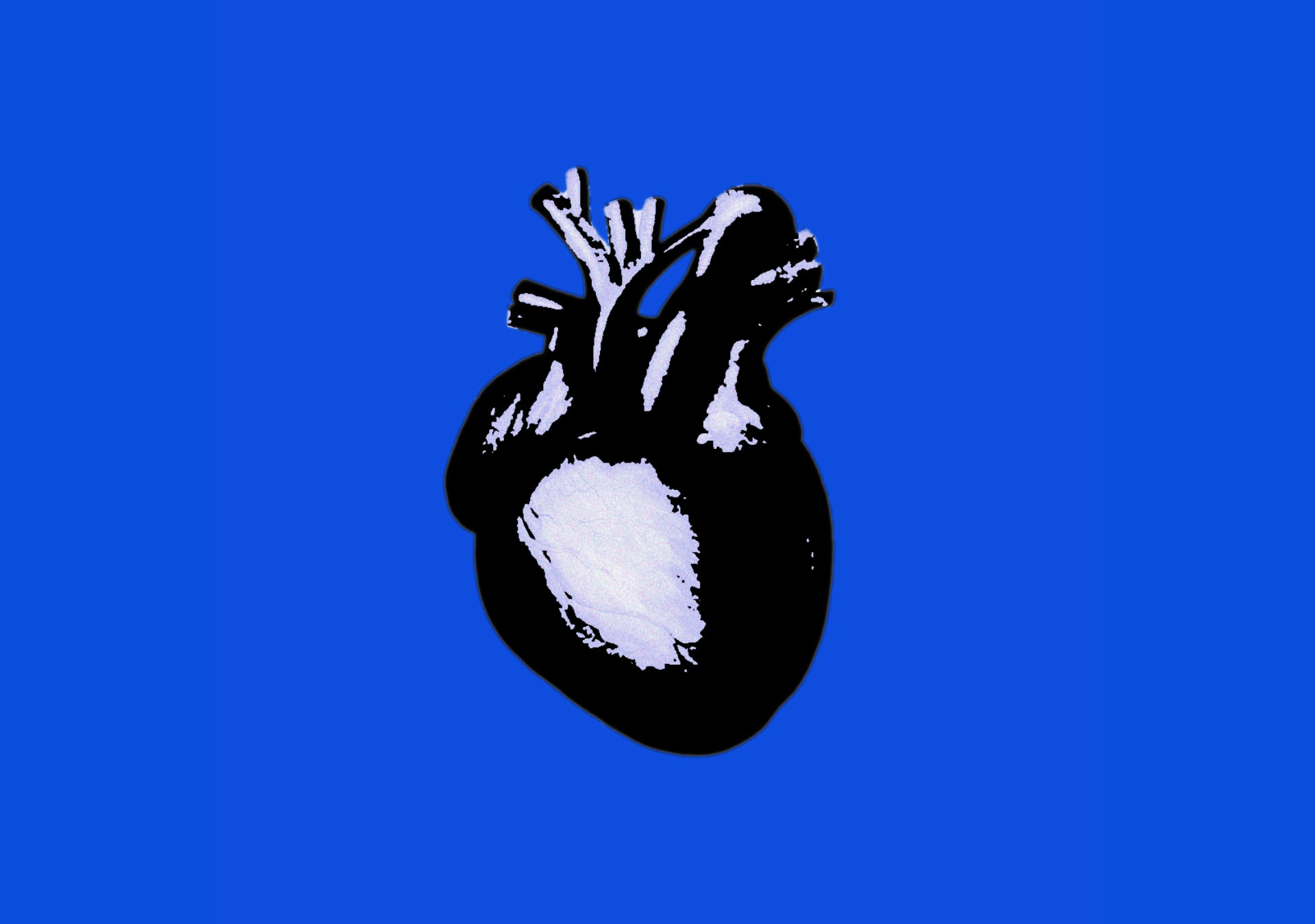 Illustration av ett svartvitt anatomiskt korrekt hjärta, mot blå bakgrund